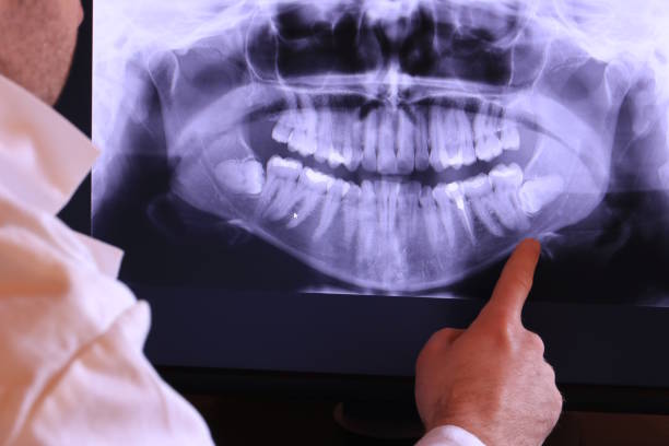 Best Emergency Dental Extractions in Stanaford, WV
