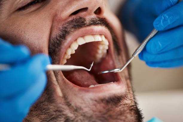 Best Emergency Dentist for Knocked-Out Tooth in Stanaford, WV